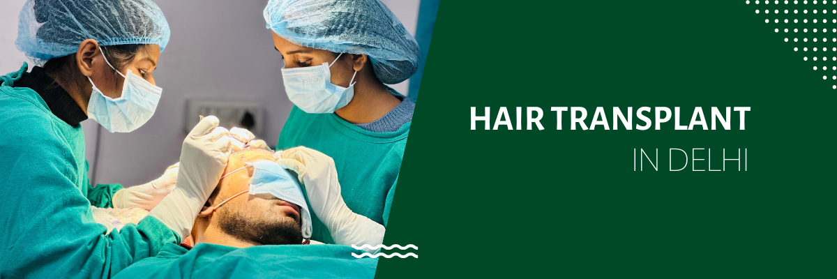 hair transplant in delhi